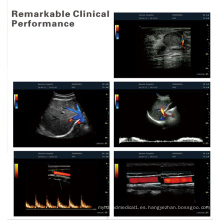 PT580 3D Color Doppler ultrasonido sistema de diagnóstico